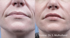 Forma Face Skin Rejuvenation Before After College Station TX