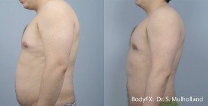 Man with flat belly after BodyFX